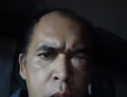 Akibat Salah Paham, Purba Korban Pemukulan Akhirnya Lapor Polisi